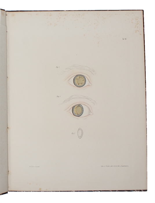 Beiträge zur Pathologie des Auges. Mit Abbildungen im Farbendruck. Textbd. + Atlas.